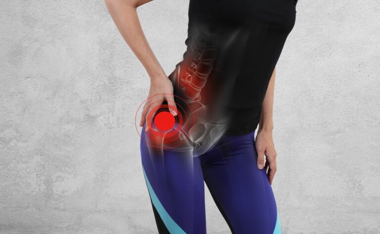 Right Hip Pain After Hiking: The Solution